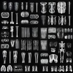X-ray images from patient, ai-generatet - 796649855