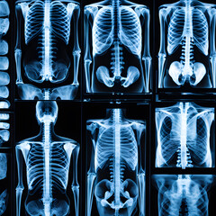 X-ray images from patient, ai-generatet - 796650443