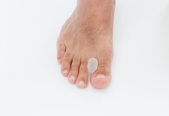 Silicone toe separator for bunion toe or hallux valgus. - obrazy, fototapety, plakaty