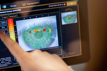 close-up of a diagnostic screen with an image of the eye indicator of moisture and dry areas check