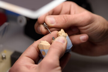 Dental prosthetics work. A dental technician works with dentures in a prosthetics laboratory. The...
