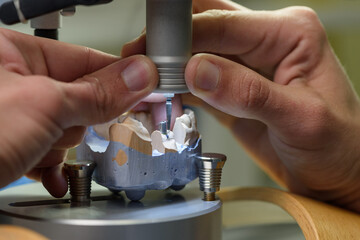 A male dental technician uses a machine with a drill on a tooth model in the laboratory. A prosthetic technician shapes teeth using a drill and a grinding cutter. Dental prosthesis on an implant