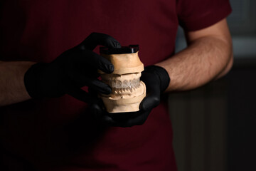 Dental technician or orthopedic dentist holding an dental model of the human jaw. Dentist hands close-up. The work of a technician in a dental laboratory. The concept of prosthetics and implantology.