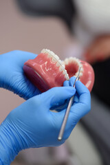 Female hands of an orthodontist in rubber gloves close-up. A dentist demonstrates artificial human...