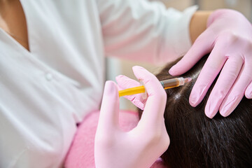 Healthcare professional treating client for hair loss with mesotherapy - 797050259