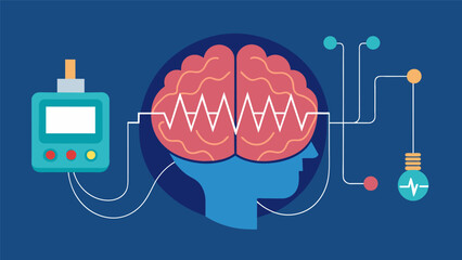 A visualization of the deep brain stimulation device emitting electrical pulses that disrupt abnormal brain activity and reduce seizures in patients.