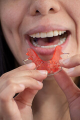 undistinguished person putting on his hawley retainers, selective focus, oral health and orthodontics concept