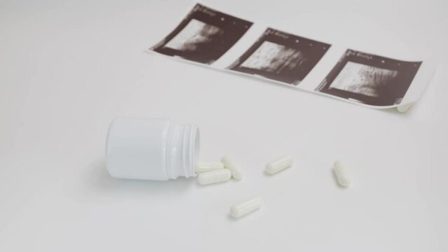 Abortion pills, medication choice, woman's health, pregnancy termination method