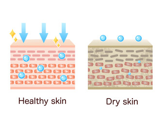 Comparison illustration of skin chart