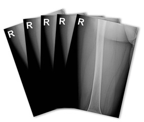 X-ray images spread out with a fan on a white background