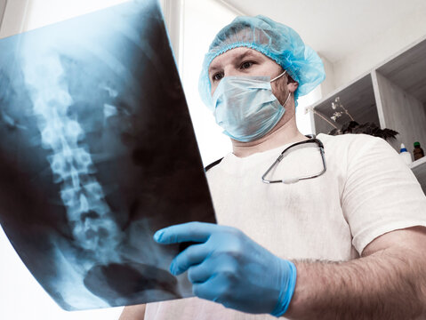 The doctor diagnoses scaliosis diseases, analyzes the disease of the human spine. Traumatologist vertebrologist with x-ray of the back of the spine of a man. Therapy of osteochondrosis