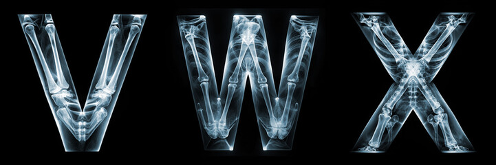 Letters V, W, X. Alphabet Made of X-ray Bones - obrazy, fototapety, plakaty