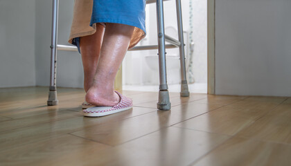 Elderly swollen feet or edema leg walk into bathroom.