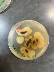 leaf bacteria growing in petri dish during microbiology classes
