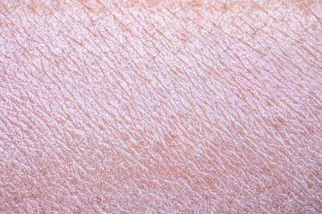 dry and dehydrated human skin texture background