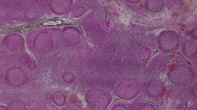 Human Pathology and Histology of Mammalia for education under the microscope in Lab.	