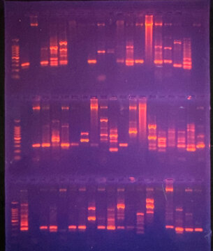 photo of DNA bands in agarose gel as shown under the UV light