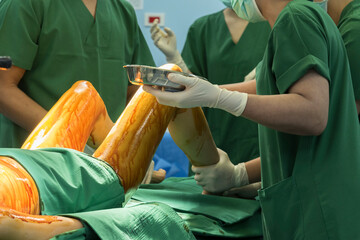 Medical team of surgeons in hospital working surgical intervention.Surgery operating room with...