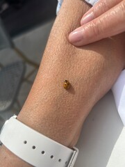 close up of a ladybug on lady’s arm