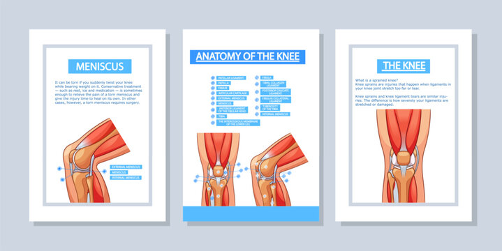 Vector Medical Poster Templates Illustrate Knee Joint Anatomy. Vertical Banners Or Flyers Showcasing Ligaments, Tendons