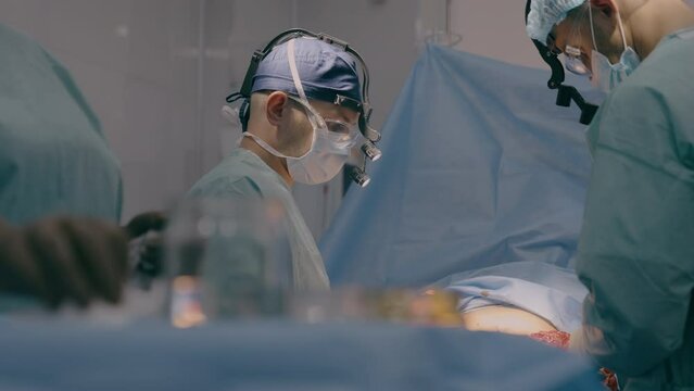 Team doctor surgeon medic nurse physician process surgical bariatric operation in operating room emergency help patient medical surgery incision stomach cancer medicine health care in hospital clinic