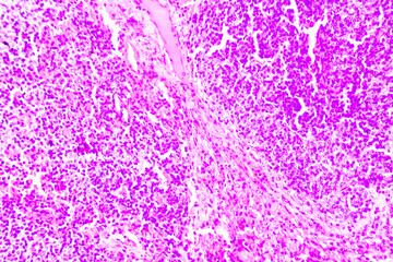 Backgrounds of human cells tissue of cervix under the microscope in pathology lab.View in...