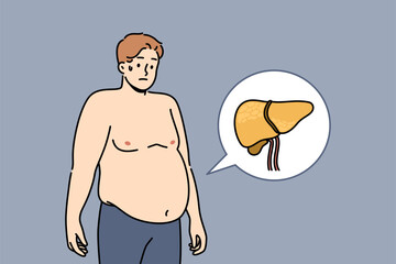 Liver illnesses in men cause obesity and digestive problems and symptoms of fatty hepatosis. Yellow liver near guy suffering from jaundice caused by poor hygiene or weakened immune system