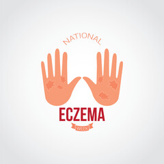 Obraz premium National Eczema Week vector illustration. National Eczema Week themes design concept with flat style vector illustration. Suitable for greeting card, poster and banner.