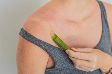 Expectant woman soothes sunburned skin with aloe leaf, embracing natural relief during pregnancy