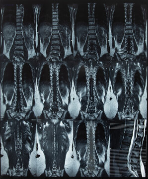 x-ray thoracic and lumbar vertebrae spine x-ray film images by mri ct scan of spine anatomy for a medical diagnosis.