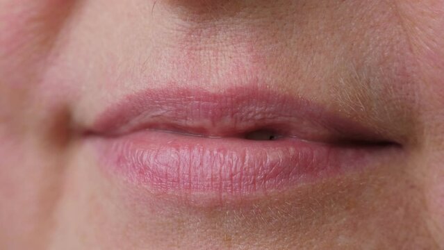 Unrecognizable woman with bad broken teeth. Female mouth with damaged and cracked tooth. Closeup