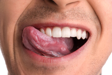 Young man with healthy teeth, closeup