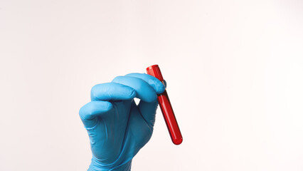 A vial with blood in the hand of a doctor in a blue glove on a white background.