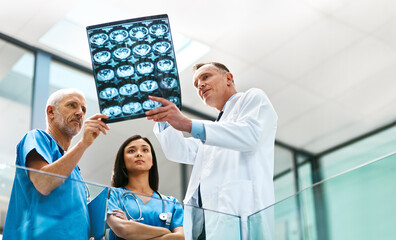 Doctor, team and x ray for healthcare in hospital, analysis and check results of patient MRI....