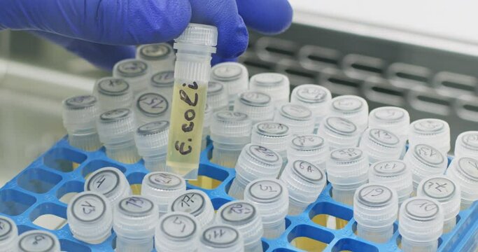 Medical worker hand takes test tube with yellow liquid and text E Coli from rack closeup. Assistant studies urine sample with dangerous bacterium