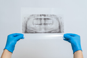 Jaw radiography image. Dental x-ray of pacient oral cavity with teeth