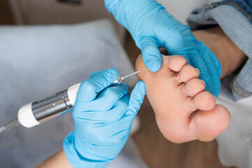 Professional removing a callus on a womans foot by electric drill