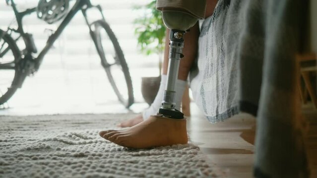 Male person with a prosthetic leg turns off the alarm on the phone and wakes up from bed in the morning