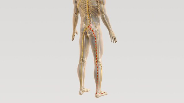 Sciatica spine and nerve pain path