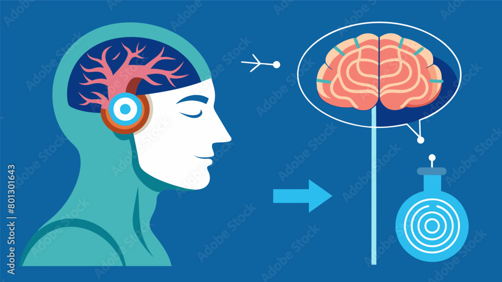 Poster a before and after graphic showing the effects of deep brain stimulation on a patient with chronic p