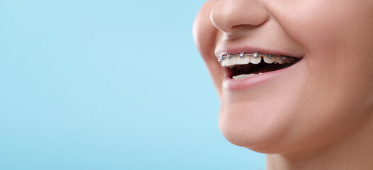 Smiling woman with braces on light blue background, closeup. Banner design with space for text