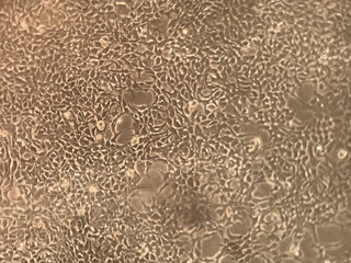 Photo taken from a microscope observing human cell culture in a biological research laboratory in vitro