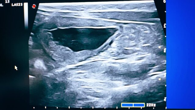 close-up in veterinary clinic screening on an abdominal ultrasound monitor