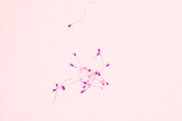 Human sperms viewed in the microscopic for male fertility test.Spermatozoa on white...