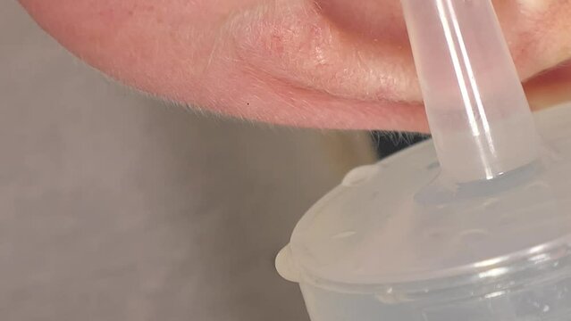 A closer look of the ear rinsing procedure on the man using a syringe with the liquid on it. 