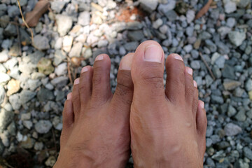a pair of men legs, dark brown in color. around thirty years old. gravel background