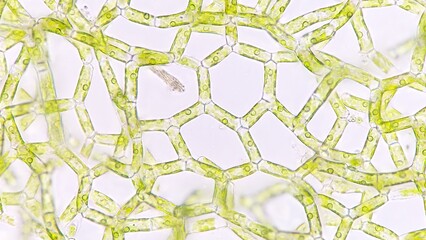 The water net (Hydrodictyon sp) under microscope. Collected from paddy fields in Indonesia. 