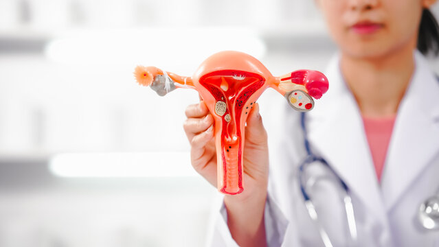 Female doctor specializing in online consultations for reproductive health issues endometriosis, uterine fibroids, gynecologic cancer, HIV/AIDS, interstitial cystitis, PCOS, STDs