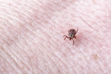 Adult female tick - Ixodes ricinus.A predatory parasitic tick crawls along the human body.Carrier of infectious diseases as encephalitis or Lyme borreliosis.