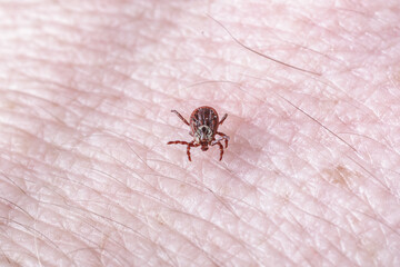 Adult female tick - Ixodes ricinus.A predatory parasitic tick crawls along the human body.Carrier of infectious diseases as encephalitis or Lyme borreliosis.